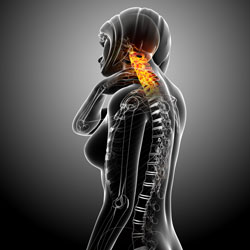 Neck and cervical spine medical illustration