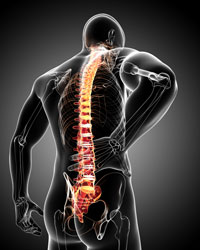 Spine and back pain medical illustration